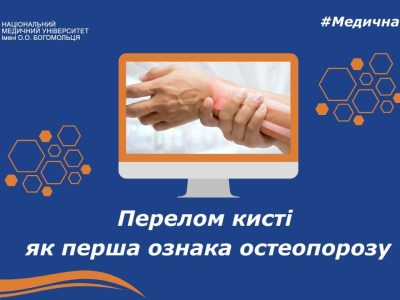 Перелом променевої кістки: чому ця травма може бути першим симптомом остеопорозу