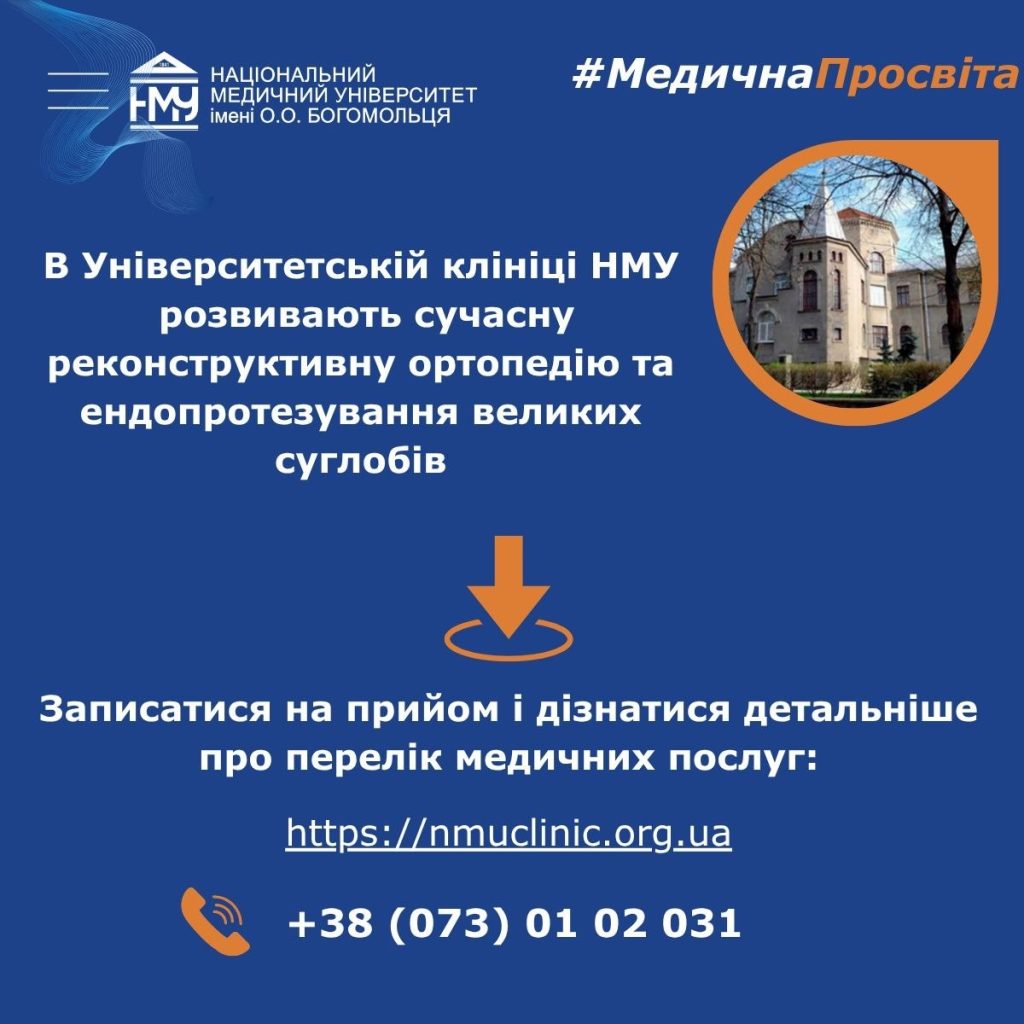 Перелом променевої кістки: чому ця травма може бути першим симптомом остеопорозу